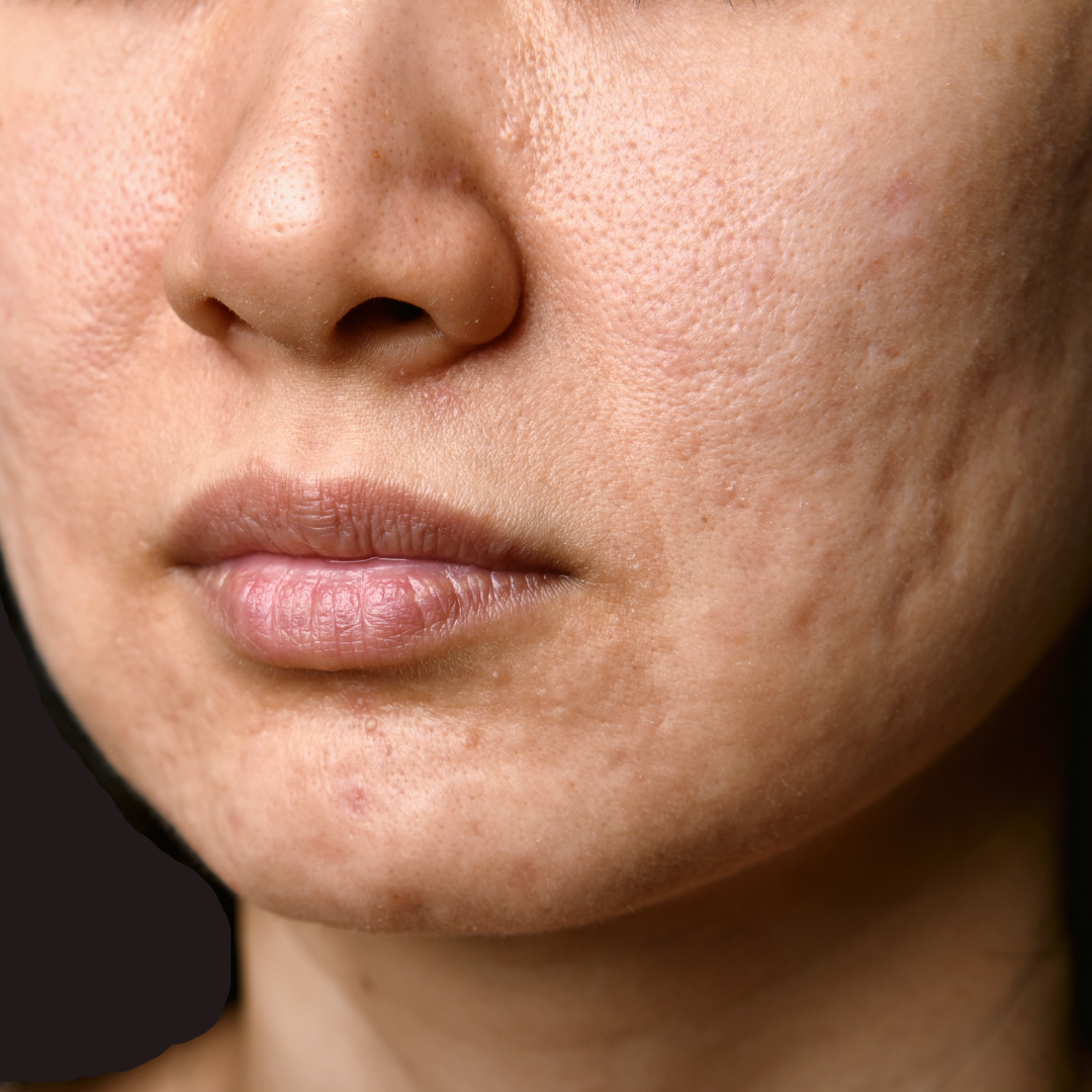 cicatrice sur le visage